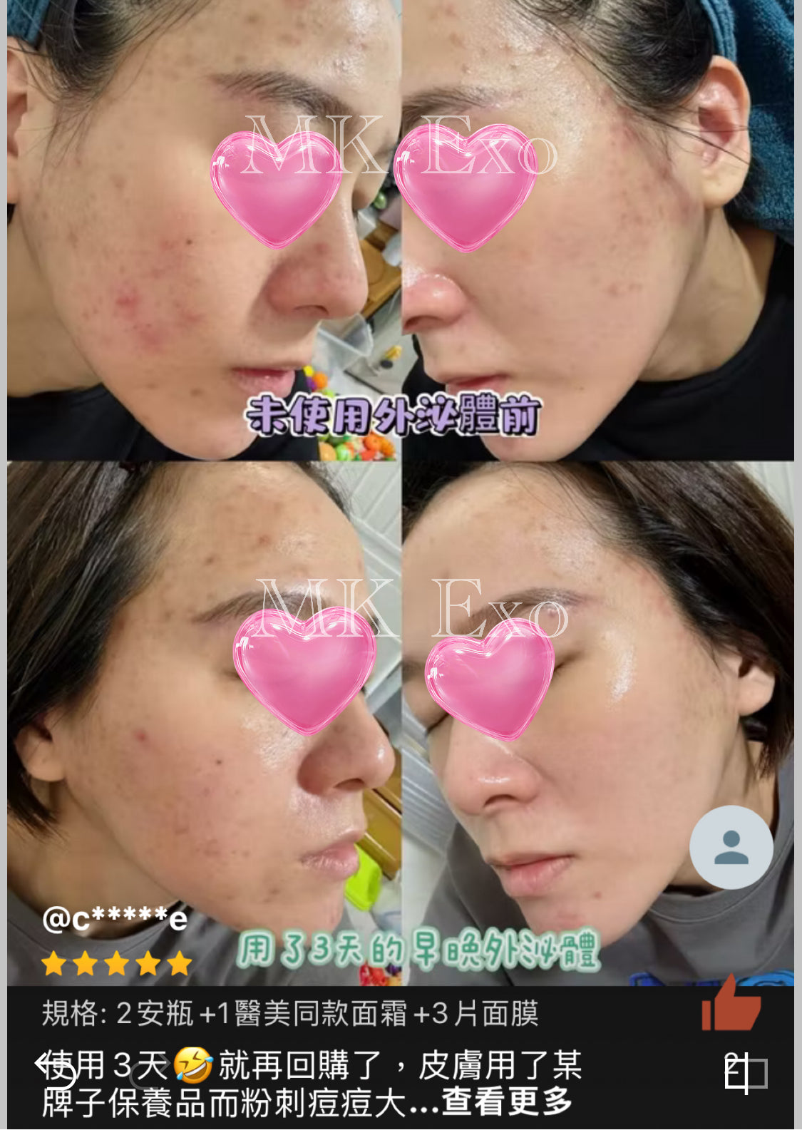 韓國大廠Exocobio 玫瑰外泌體 產品系列 Celltweet rose exosome calming ampoule 玫瑰外泌體安瓶