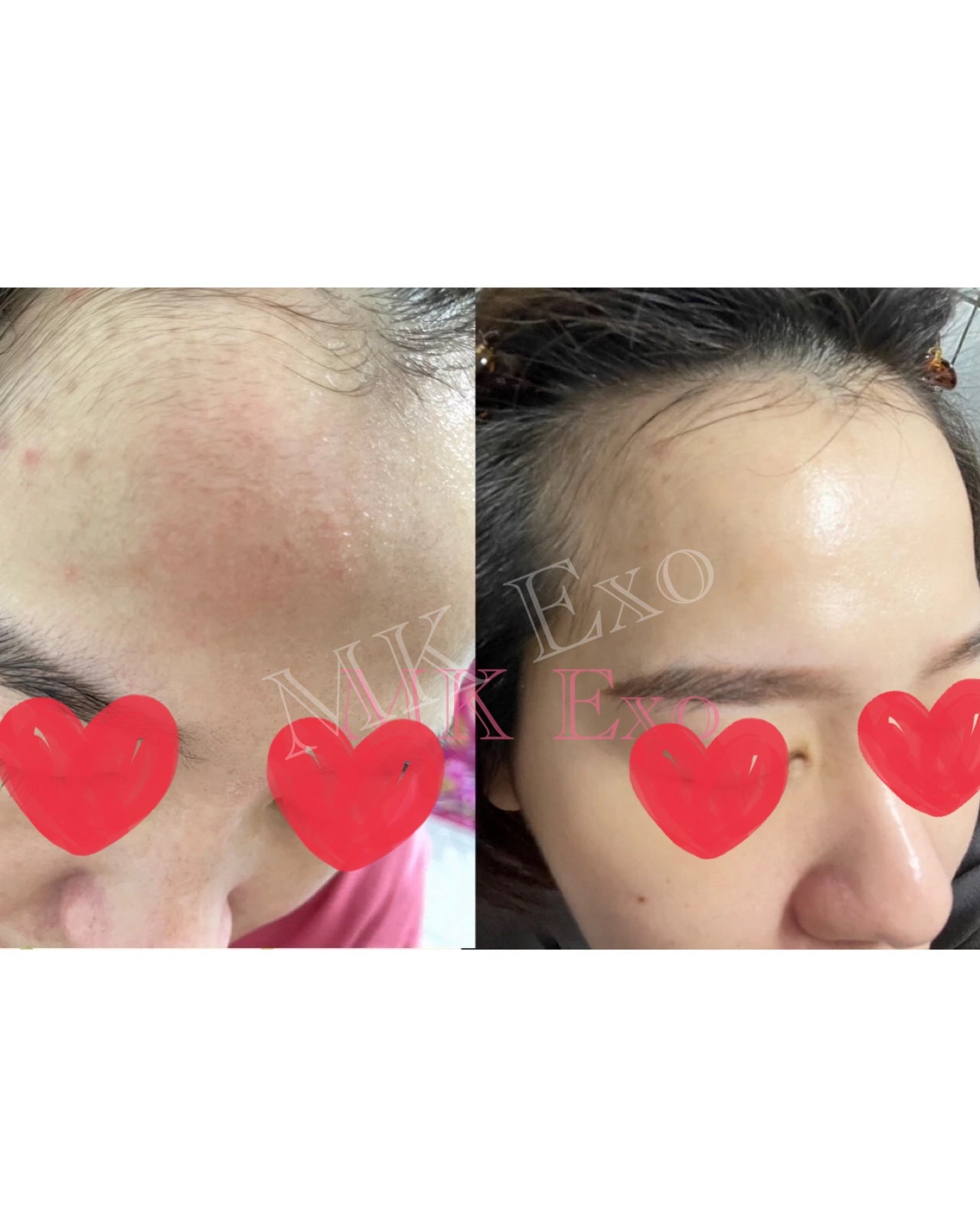 Exocobio 玫瑰外泌體 產品系列Exomage 高濃度外泌體安瓶