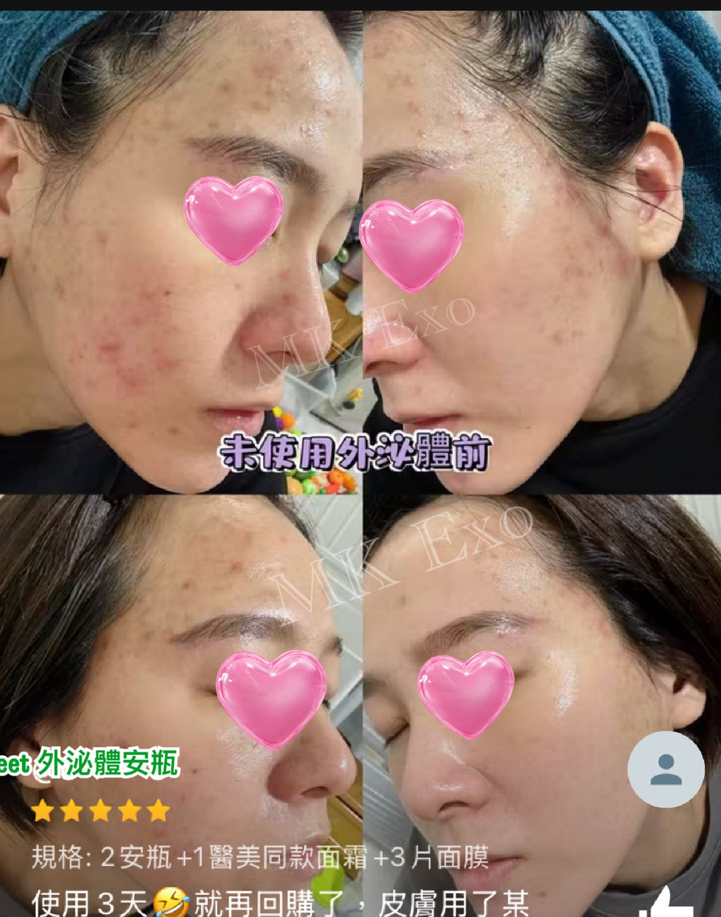 韓国の大手メーカーExocobioが、Celltweet Rose Exosome Calming Ampouleシリーズを発表しました。