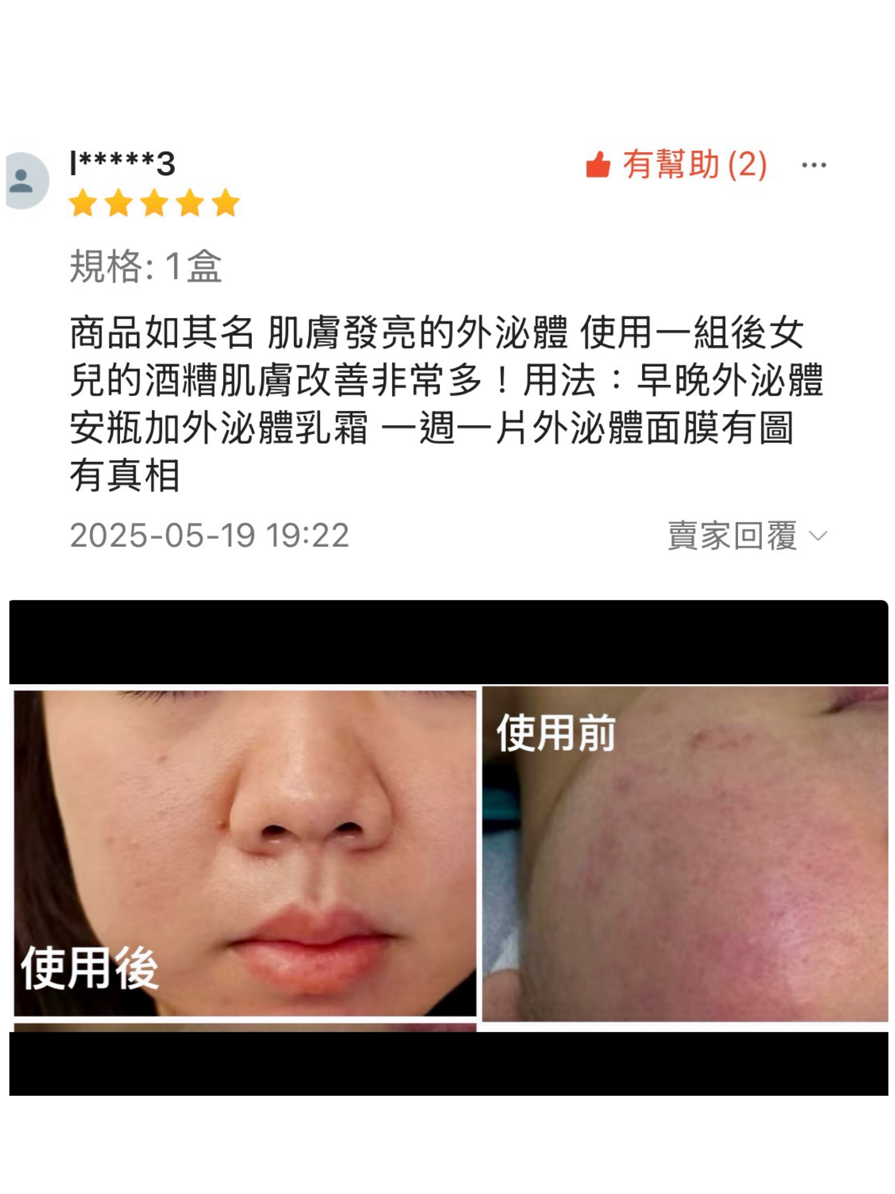 韓國大廠Exocobio 產品系列 Celltweet rose exosome calming ampoule 玫瑰外泌體安瓶