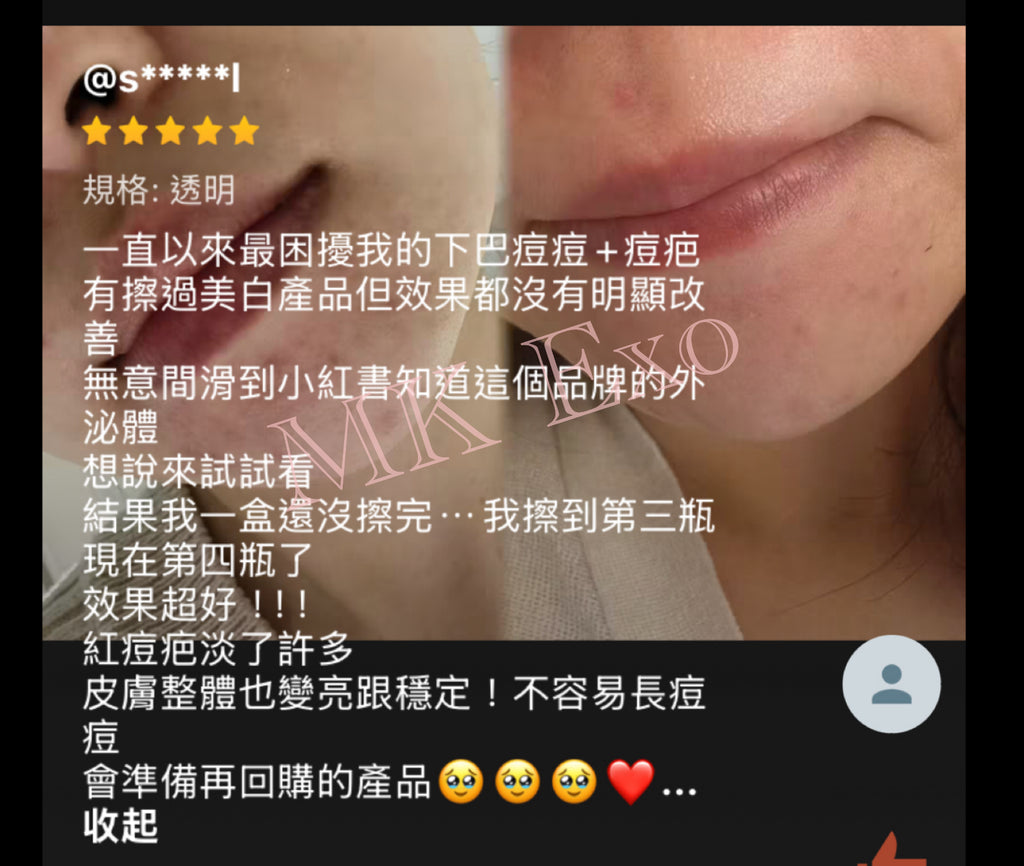 韓國大廠Exocobio 玫瑰外泌體 產品系列 Celltweet rose exosome calming ampoule 玫瑰外泌體安瓶