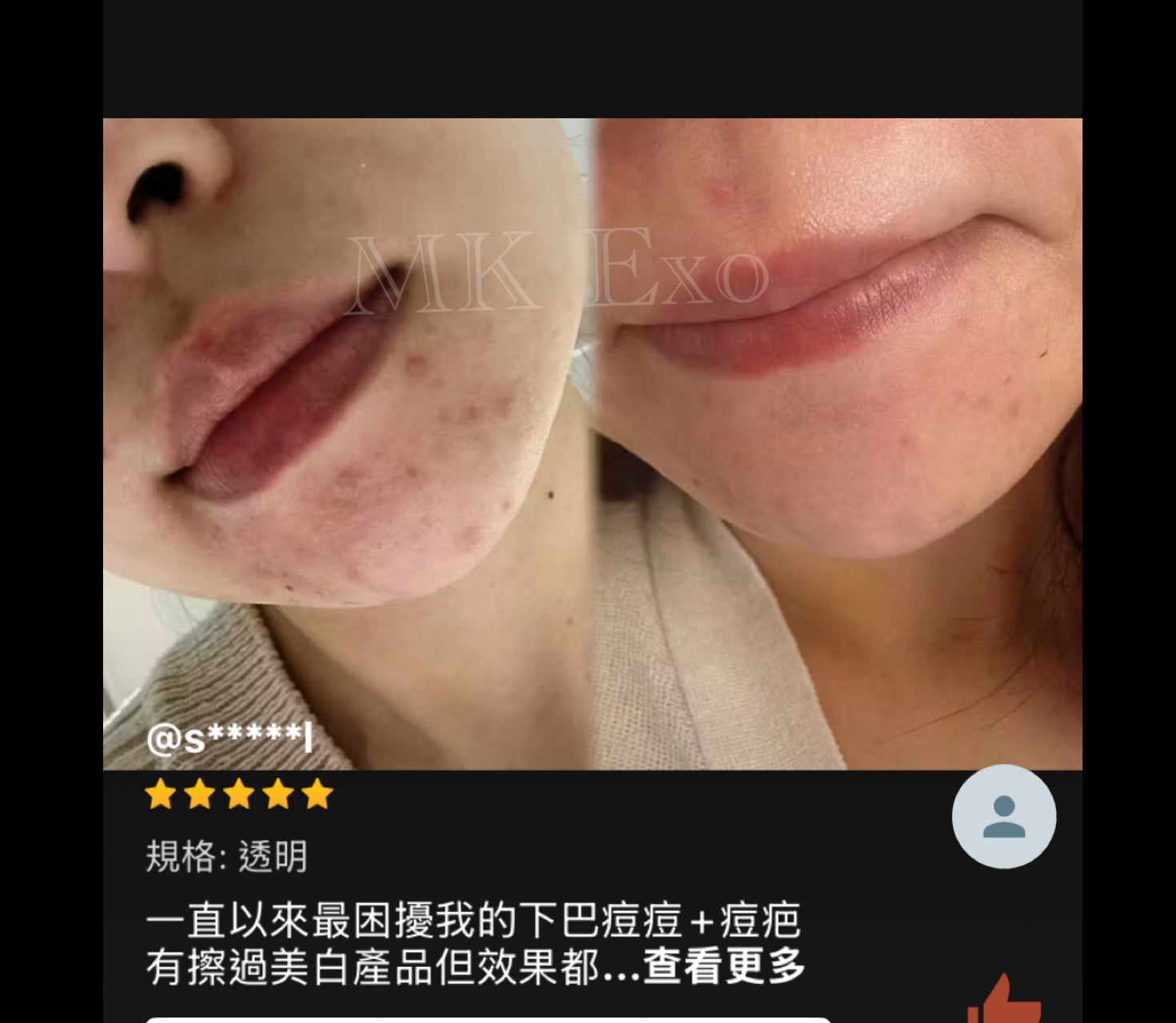 韓國大廠Exocobio 玫瑰外泌體 產品系列 Celltweet rose exosome calming ampoule 玫瑰外泌體安瓶