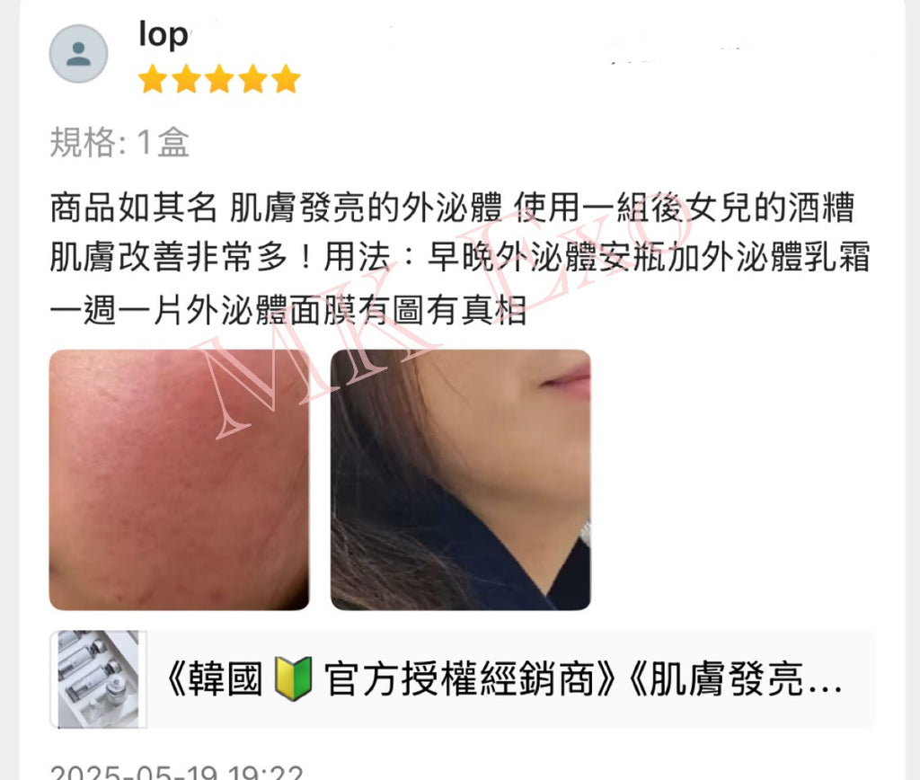 韓國大廠Exocobio 玫瑰外泌體 產品系列 Celltweet rose exosome calming ampoule 玫瑰外泌體安瓶