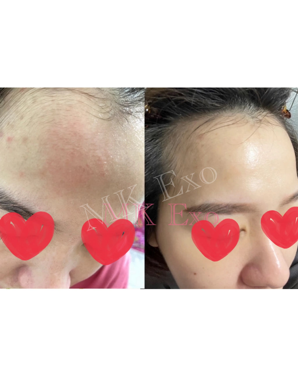 Exocobio 玫瑰外泌體 產品系列Exomage 高濃度外泌體安瓶